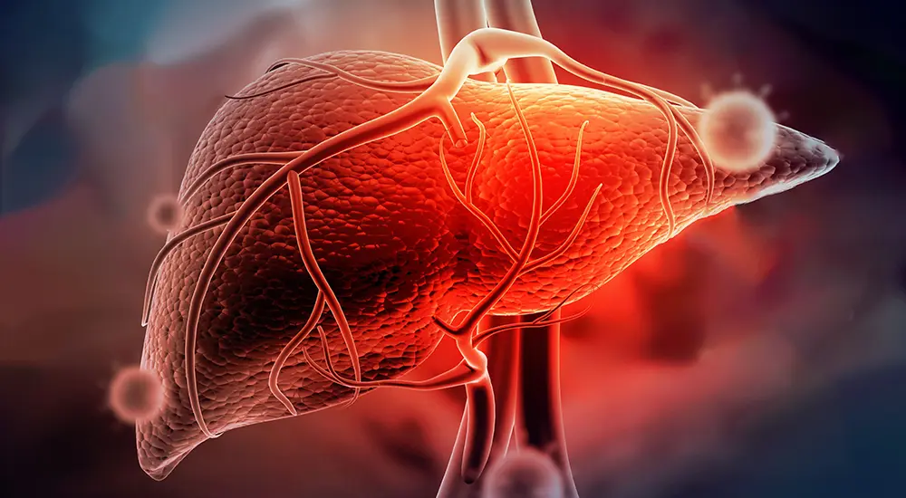 سرطان کبد چیست؟